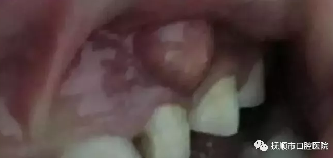 blob.png blob.png